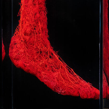 K&ouml;rperwelten Ausstellung Nordlicht 14